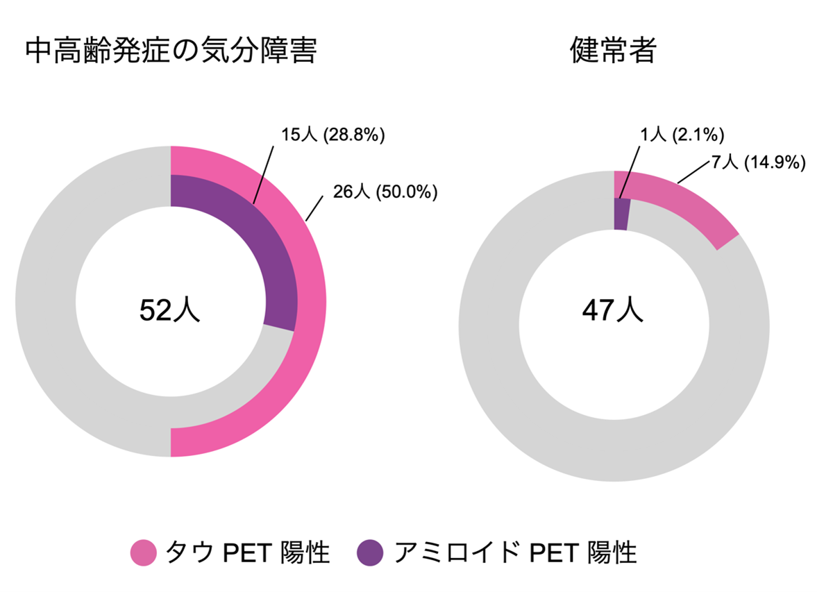 中高齢発症の気分障害に認知症の原因タンパク質が関わることを脳画像で実証～QSTの独自技術でタウタンパク質病変を可視化し、客観的診断・治療へ～