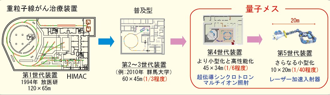第一世代装置から第5世代の量子メスまでの大きさを比較したイラスト