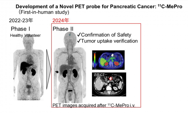 Development of a Novel PET probe for Pancreatic Cancer