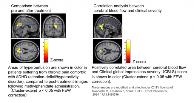 Comparison between pre and after treatment