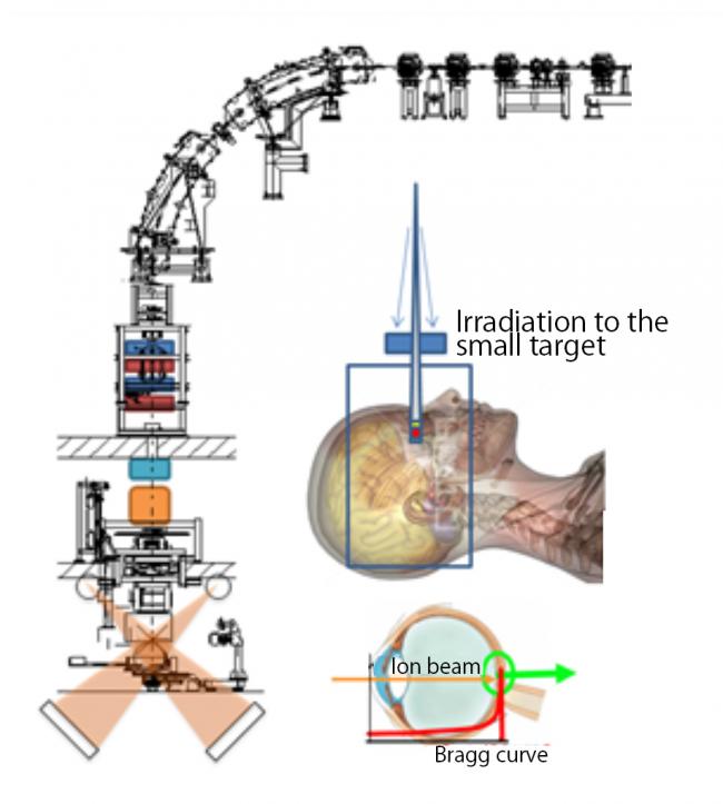 Conseptual diagram of irradition port for microsurger