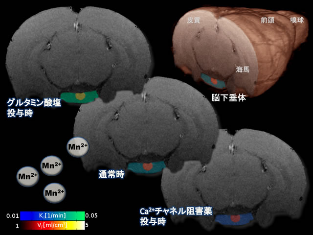 脳下垂体の機能を調べるdMEMRI法で撮影されたラット脳