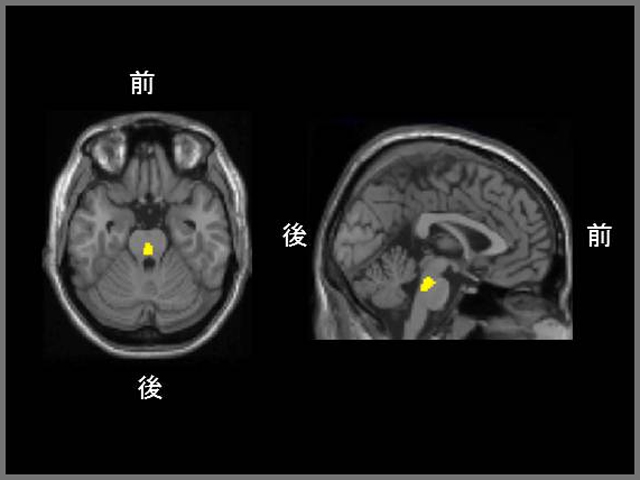 図3の関係が認められた背側縫線核を含む中脳部分（黄色）。