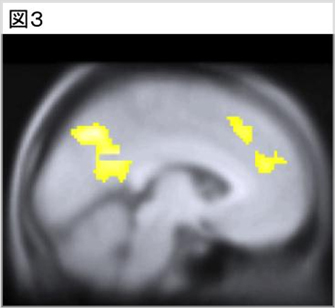 fMRIで撮影した被験者の脳の断面図（側面から撮影）