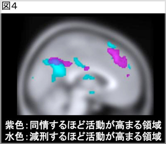 fMRIで撮像した被験者の脳の断面図（側面から撮影）