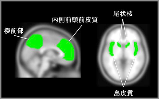 尾状核の画像