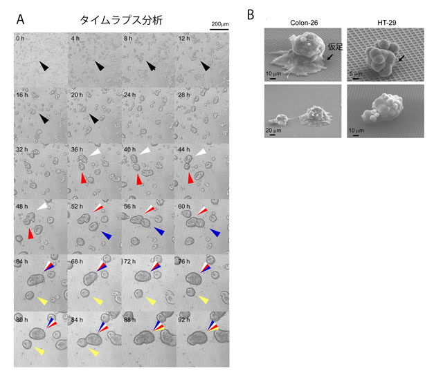 A: 新培養法のよる細胞挙動のタイムラプス分析（4時間ごと、4.5日間の解析、HT-29細胞）、B:　スフェロイド構造の走査型電子顕微鏡観察、仮足を伸ばし底面の格子構造に接着している様子が観察できる