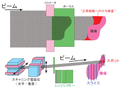拡大ビーム照射法（上図）と3次元スキャニング照射法（下図）の概念図