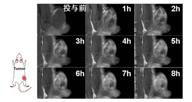 腫瘍に集まるナノ粒子