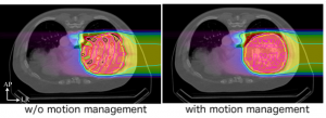 w/o motion manegement with motion management