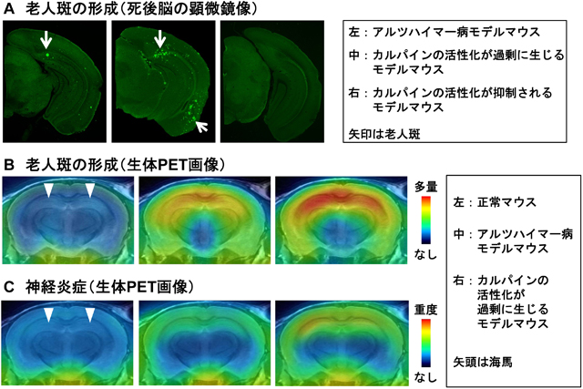 アルツハイマー病モデルマウスにおいて、カルパイン活性化が老人斑の形成と神経炎症に及ぼす影響