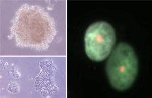 Proliferating glioma cell line (spheroid, upper left) and pancreatic cancer cell line (lower left) DNA double-strand breaks (red