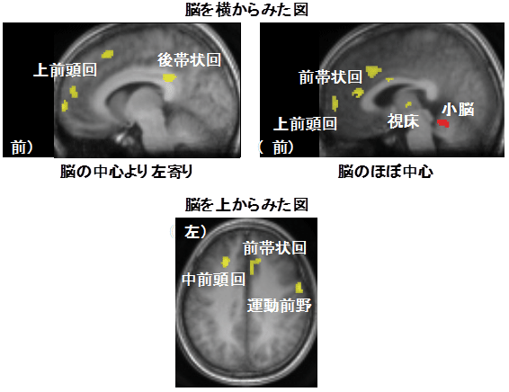 実行機能課題中にかむ動作で活動が上昇した部位（黄色）と減少した部位（赤色）