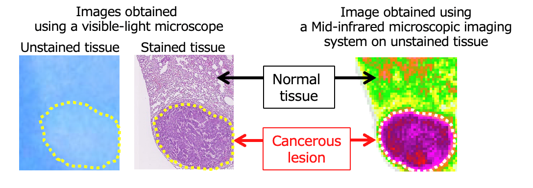 Comparison of images obtained using a visible-light microscope and a Mid-infrared microscopic imaging system