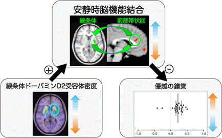 優越の錯覚の脳内システム概念図