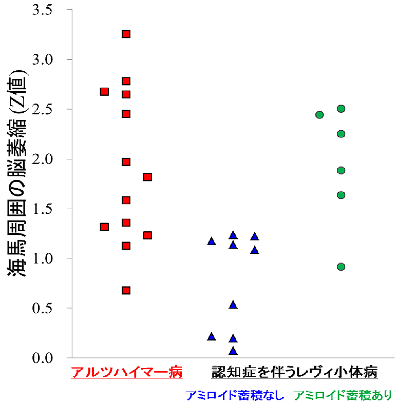 MRIで測定した海馬周囲の脳萎縮