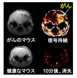 フリーラジカルへの抵抗性を反映する薬剤を投与して10分後の信号変化をカラーで示す