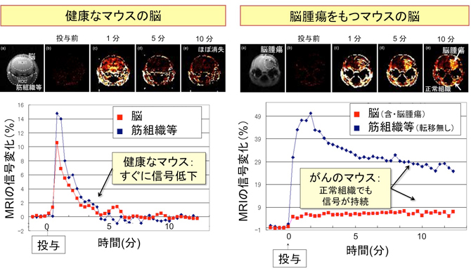 健康なマウスの脳（左）と脳腫瘍をもつマウスの脳（右）のMRIの信号変化