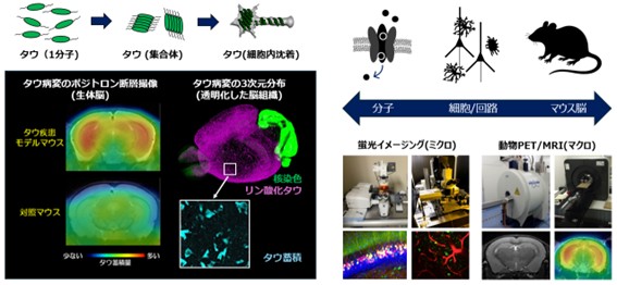 生体イメージングを基軸とした認知症モデルマウス病態の解明