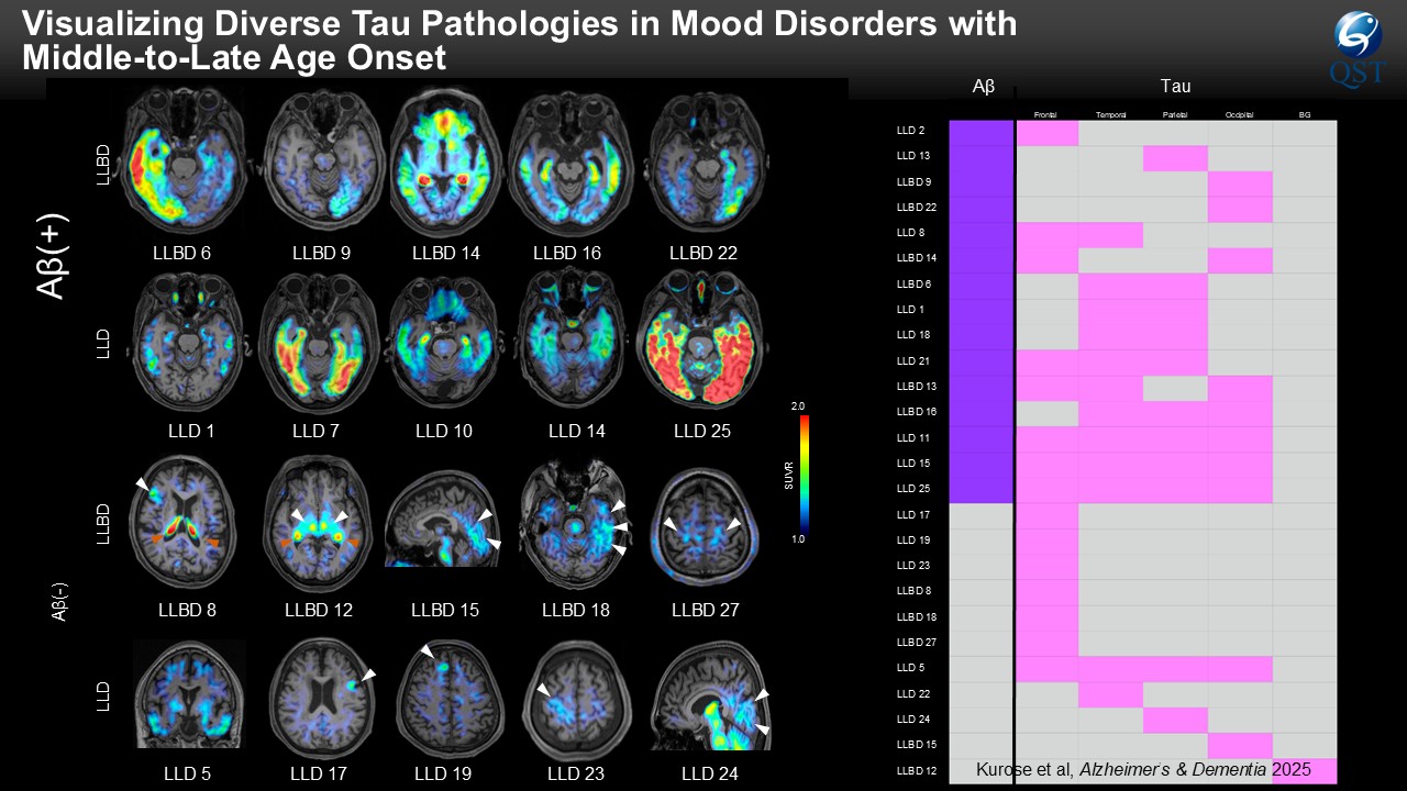 Visualizing Diverse Tau Pathologies in Mood Disorders with Middle-to-Late Age Onset