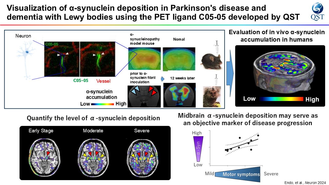 Visualization of α-synuclein deposition in Parkinson’s disease and dementia with Lewy bodies using PET ligand developed by QST