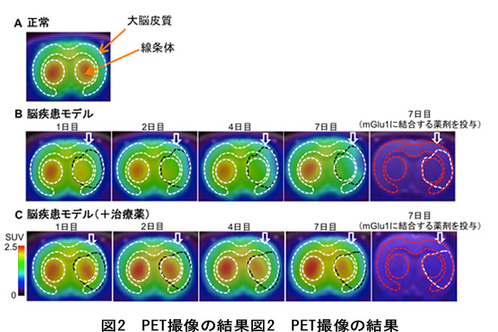 PET撮像の結果