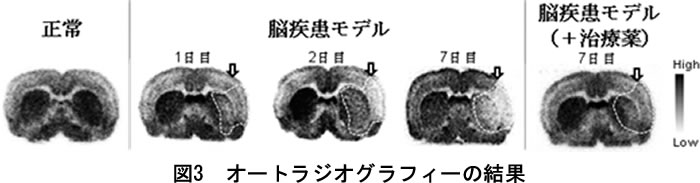 オートラジオグラフィーの結果