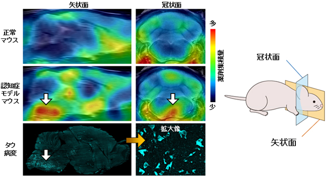 [11C]PBB3投与後の認知症モデルマウス脳PET画像