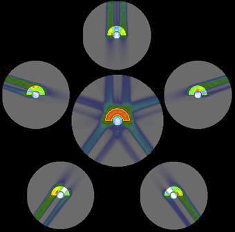回転ガントリーを使用した重粒子線治療の照射例