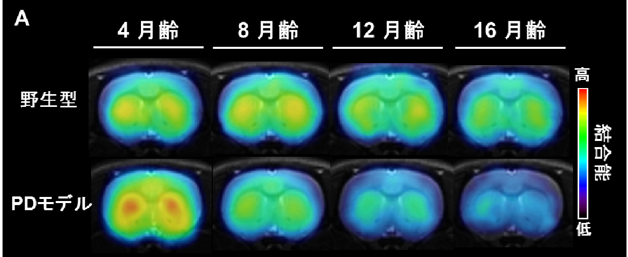 [11-C]ITDM PET画像