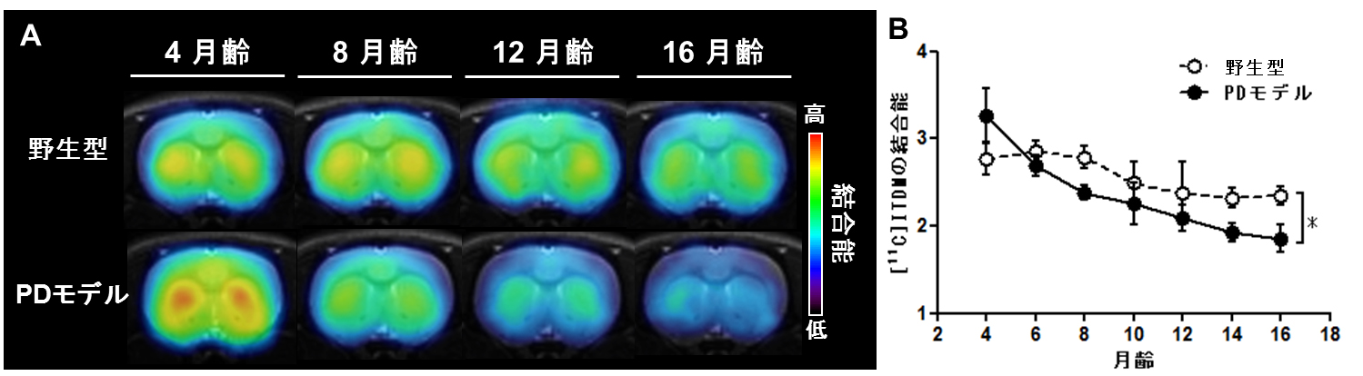 [11-C]ITDMを用いた線条体のPET定量画像