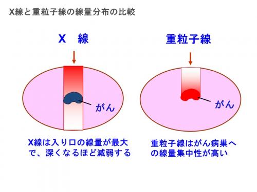 エックス線と重粒子線の体内における線量分布の模式図