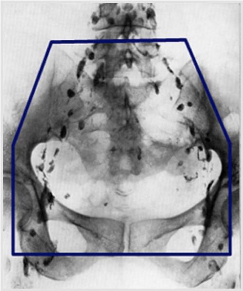エックス線画像