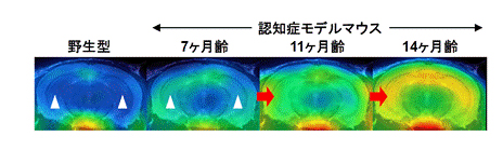 TSPOのPET薬剤である[11C]Ac5216を投与後の、マウス脳PET画像(冠状面)の画像