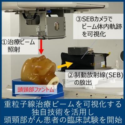 重粒子線治療ビームを可視化する独自技術を活用し頭頸部がん患者の臨床試験を開始
