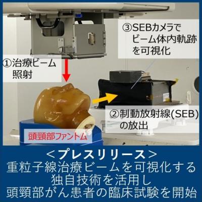 重粒子線治療ビームを可視化する独自技術を活用し頭頸部がん患者の臨床試験を開始