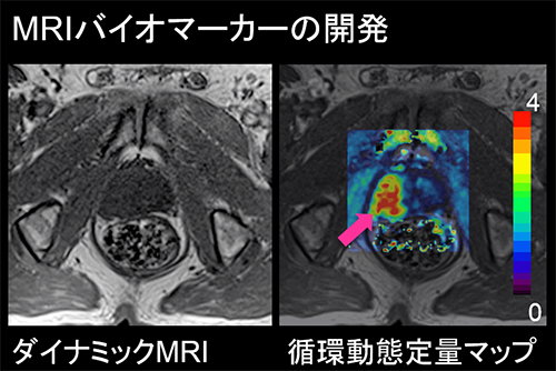 医工連携画像診断研究の画像1