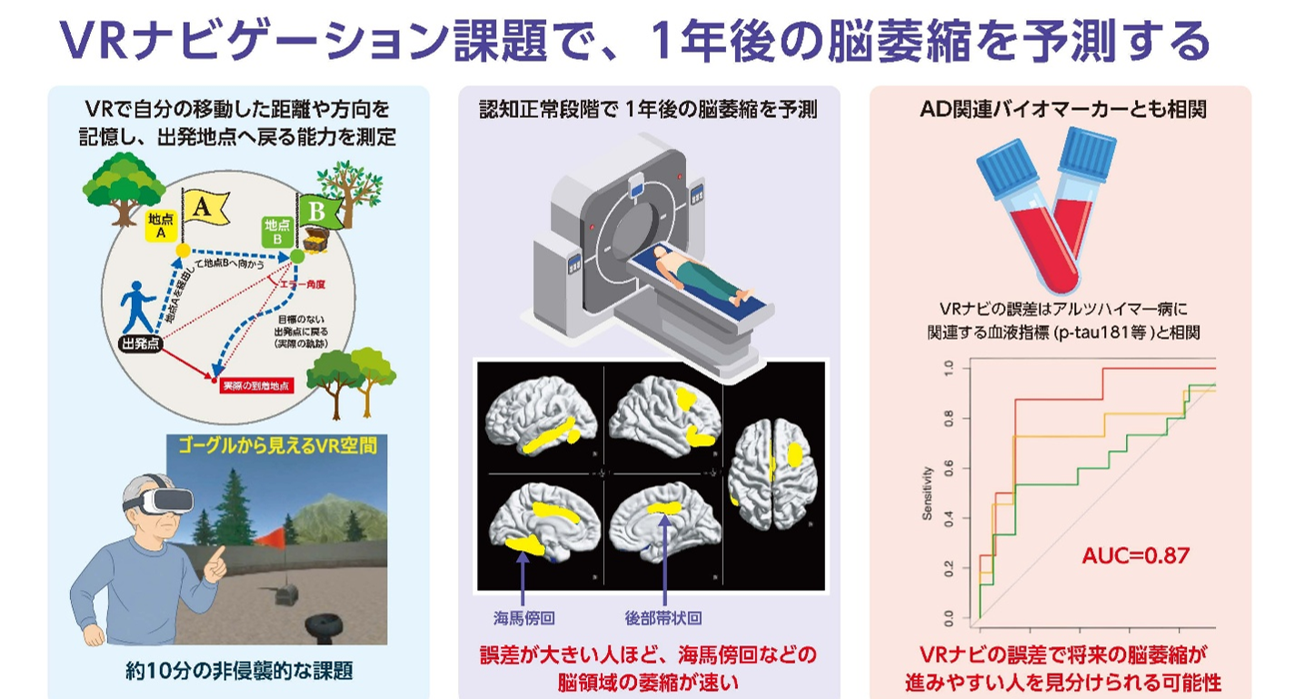 脳萎縮を予測