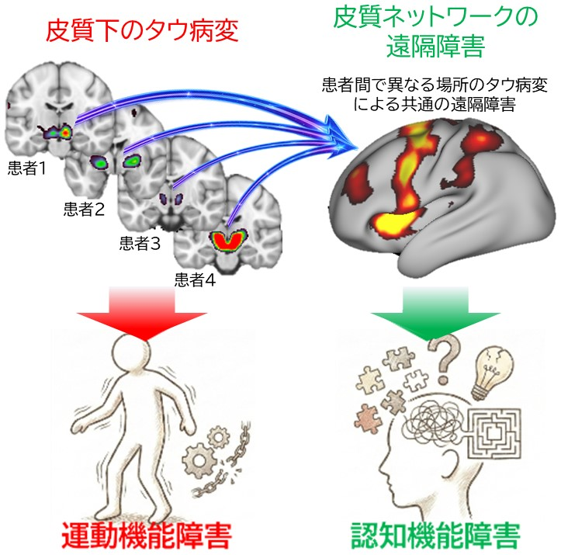 概要説明図