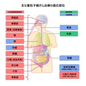 主な重粒子線がん治療の適応部位