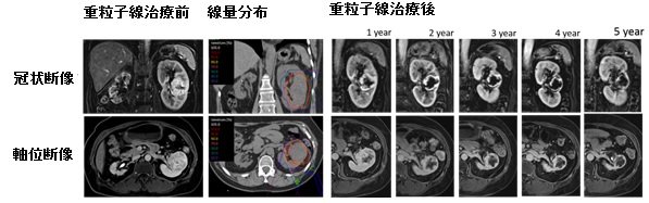 治療経過