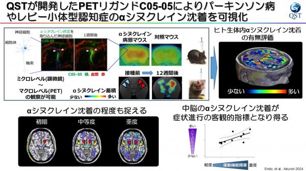 QSTが開発したPETリガンドC05-05によるパーキンソン病やレビー小体型認知症のαシヌクレイン沈着の可視化