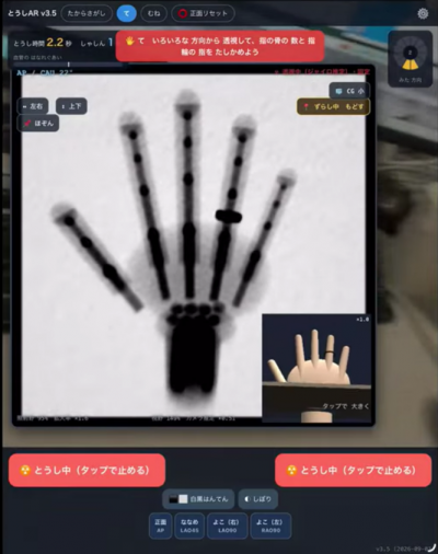 Ｘ線で手を見た時のAR画像