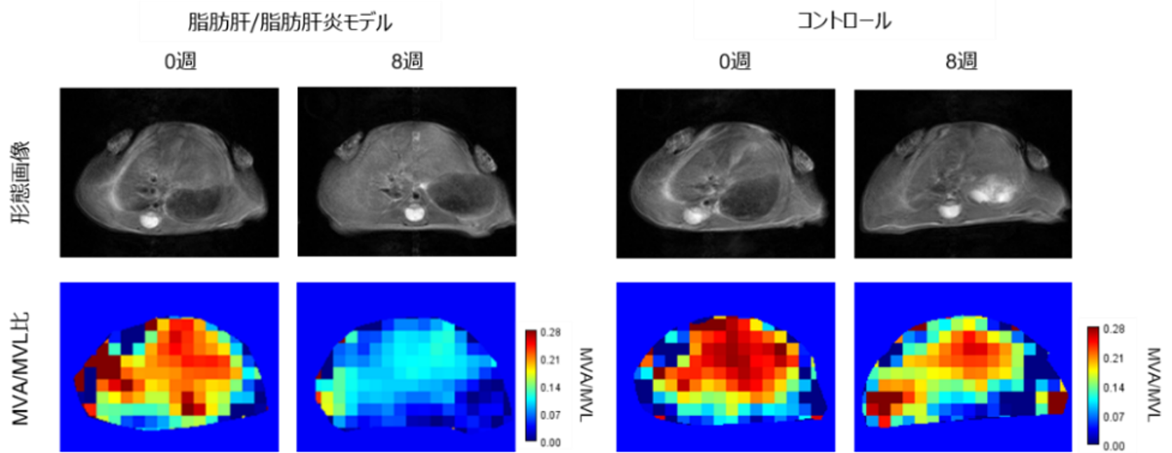 本研究で開発した超偏極MRI技術の概要