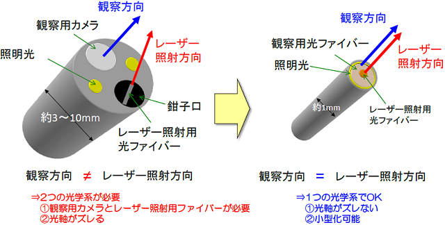 複合型光ファイバースコープの画像1