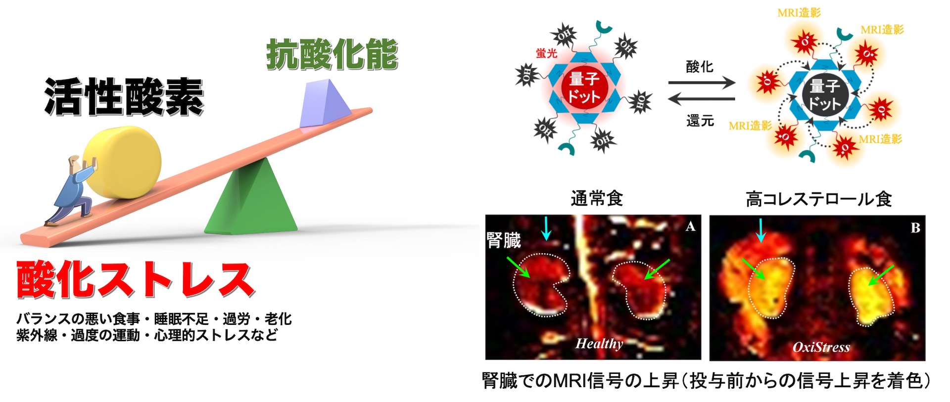 MRI量子センサーの画像