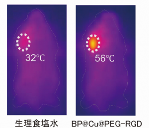 生理食塩水またはBP@Cu@PEG-RGDを投与した担癌マウスに、近赤外レーザーを2分間照射した後の近赤外画像