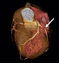 世界で初めて描出された鼓動する心臓（2005年、東京女子医科大学との共同研究）の画像2
