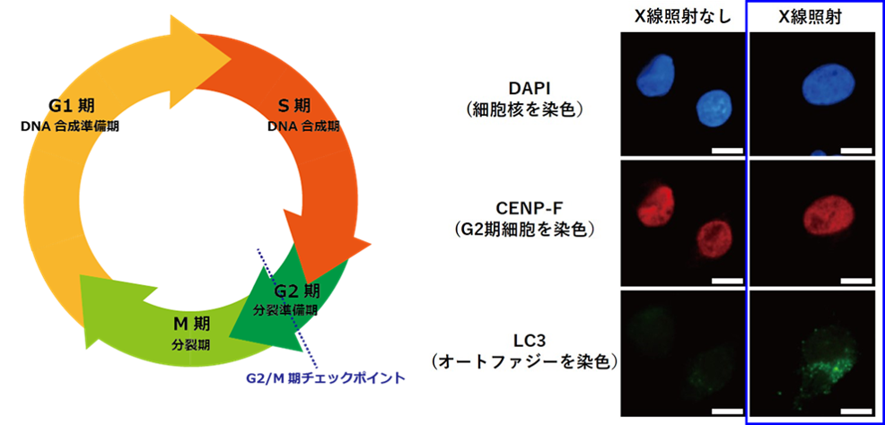 X線照射したヒト膵がん細胞におけるオートファジーの誘導